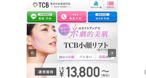 TCB(東京中央美容外科)
